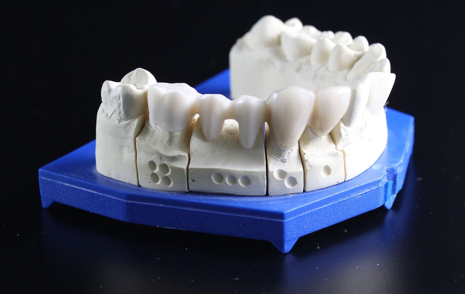 Dental crown