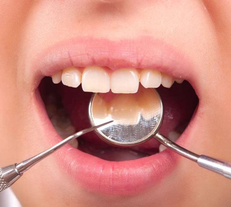 dental treatment Poland