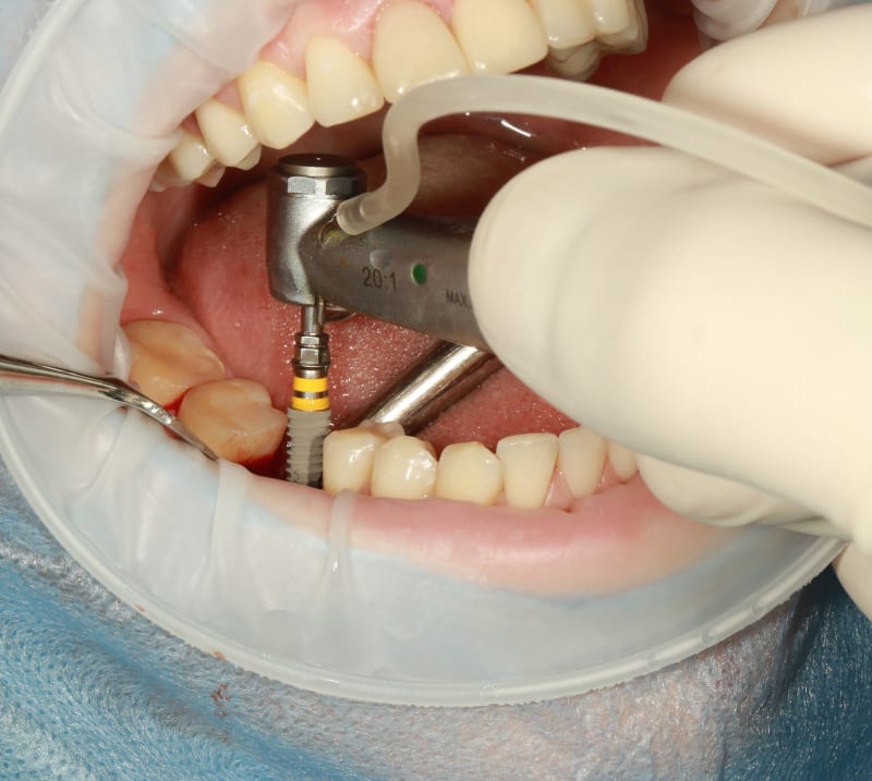 dental treatment Poland