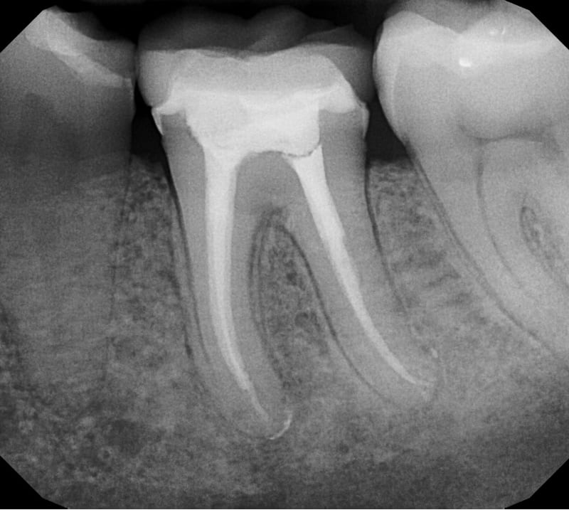 dental treatment Poland